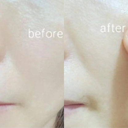 The Orvio Pure Pore – Purifying & Moisturizing Sheet Mask