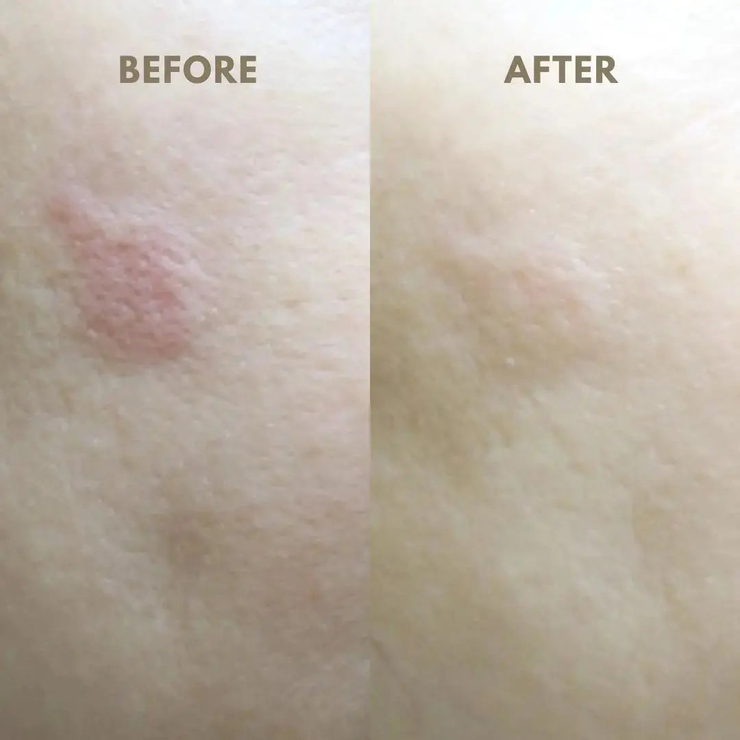 The Chila Irish – Purifying & Moisturizing Sheet Mask